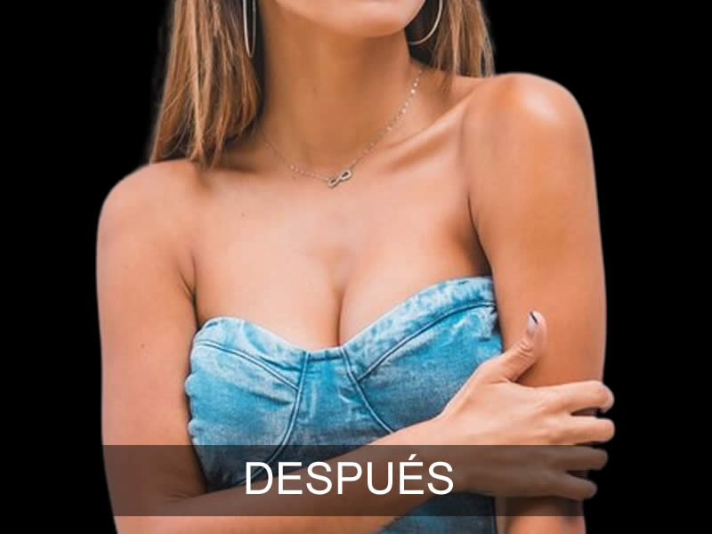 aumento-armonia-1-despues-e