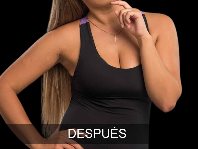 aumento-armonia-2-despues-e
