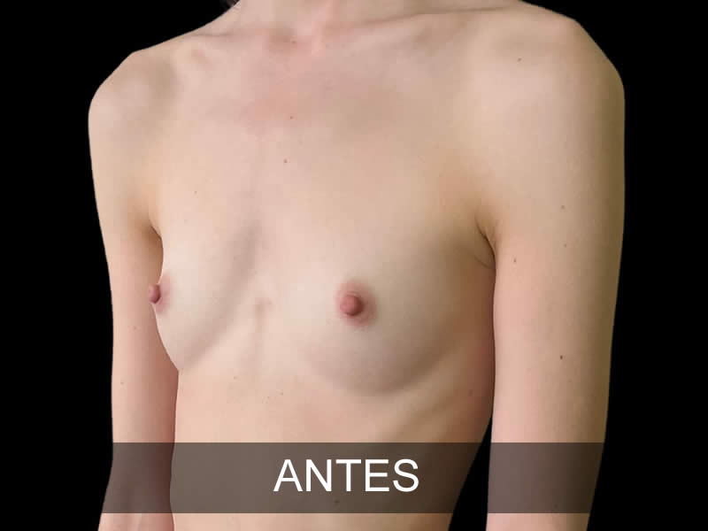 aumento-armonia-9-antes