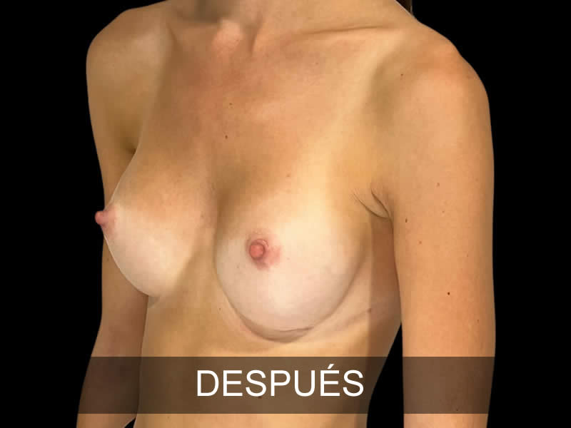aumento-armonia-9-despues