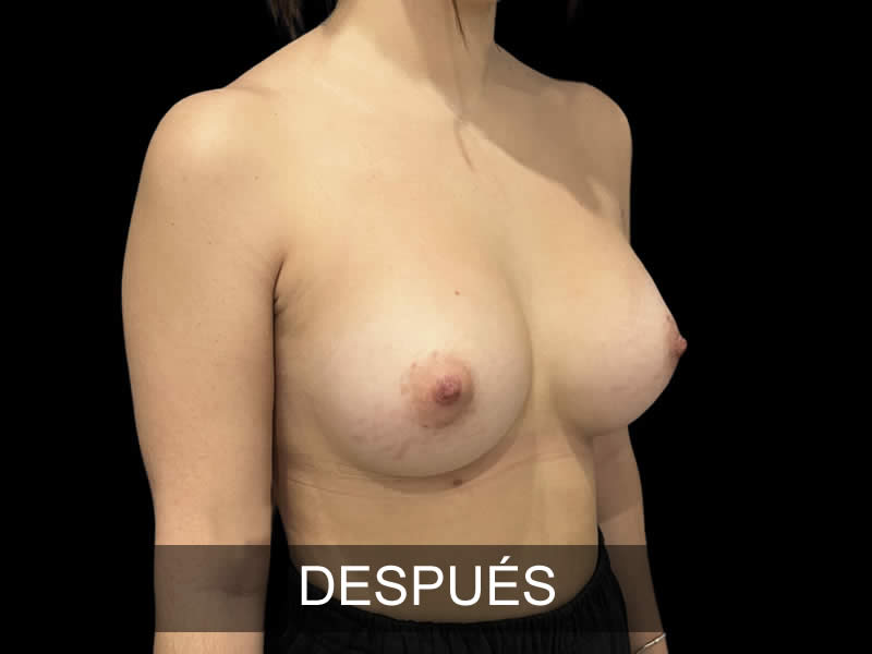 aumento-sublime-12-despues