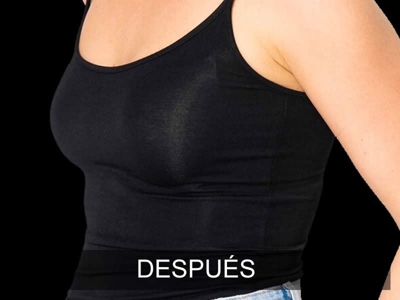 aumento-sutil-2-despues-e