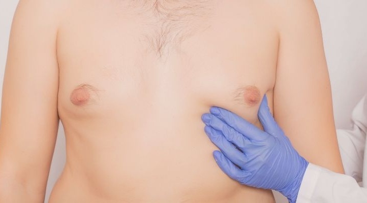 operacion ginecomastia barcelona