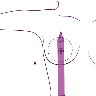 1. Creación del túnel con el Separador de Canales Motiva®