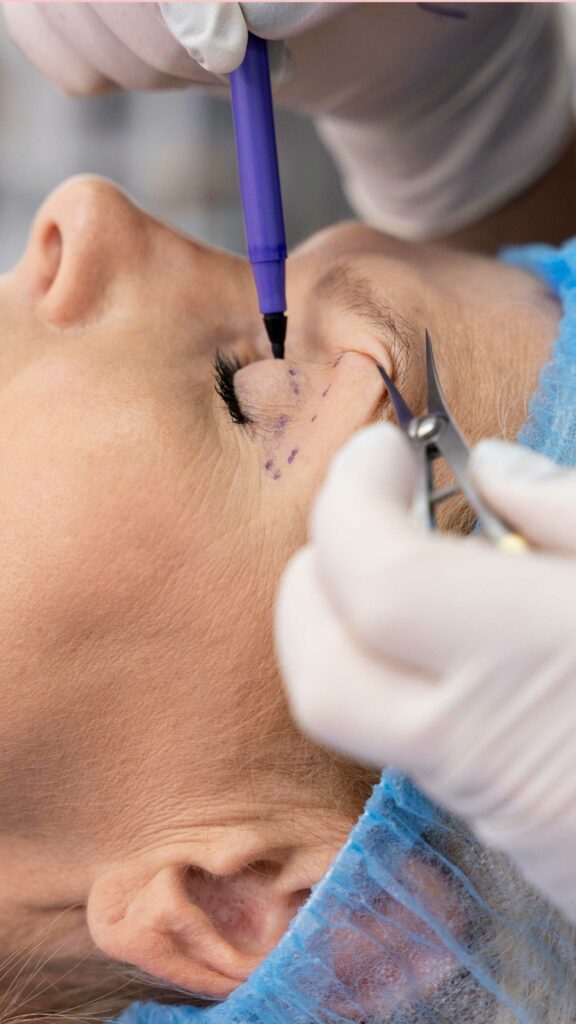 Tipo de blefaroplastia