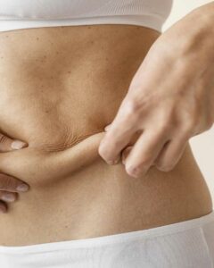 precio de abdominoplastia
