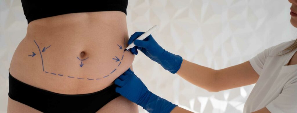 precio abdominoplastia