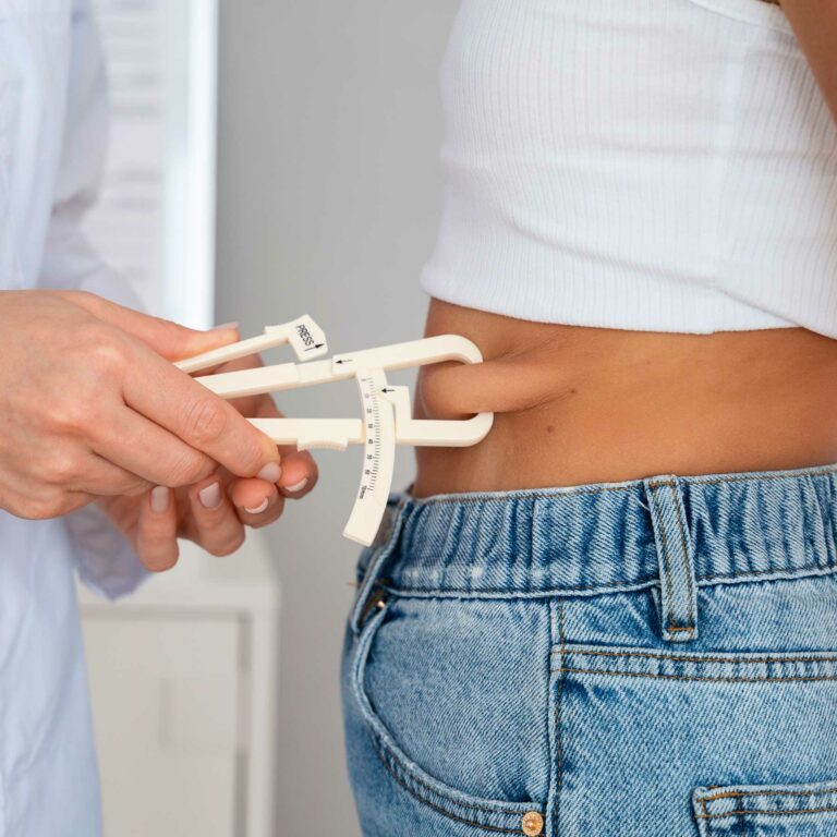 Cantidad-de-grasa-a-extraer en lipo