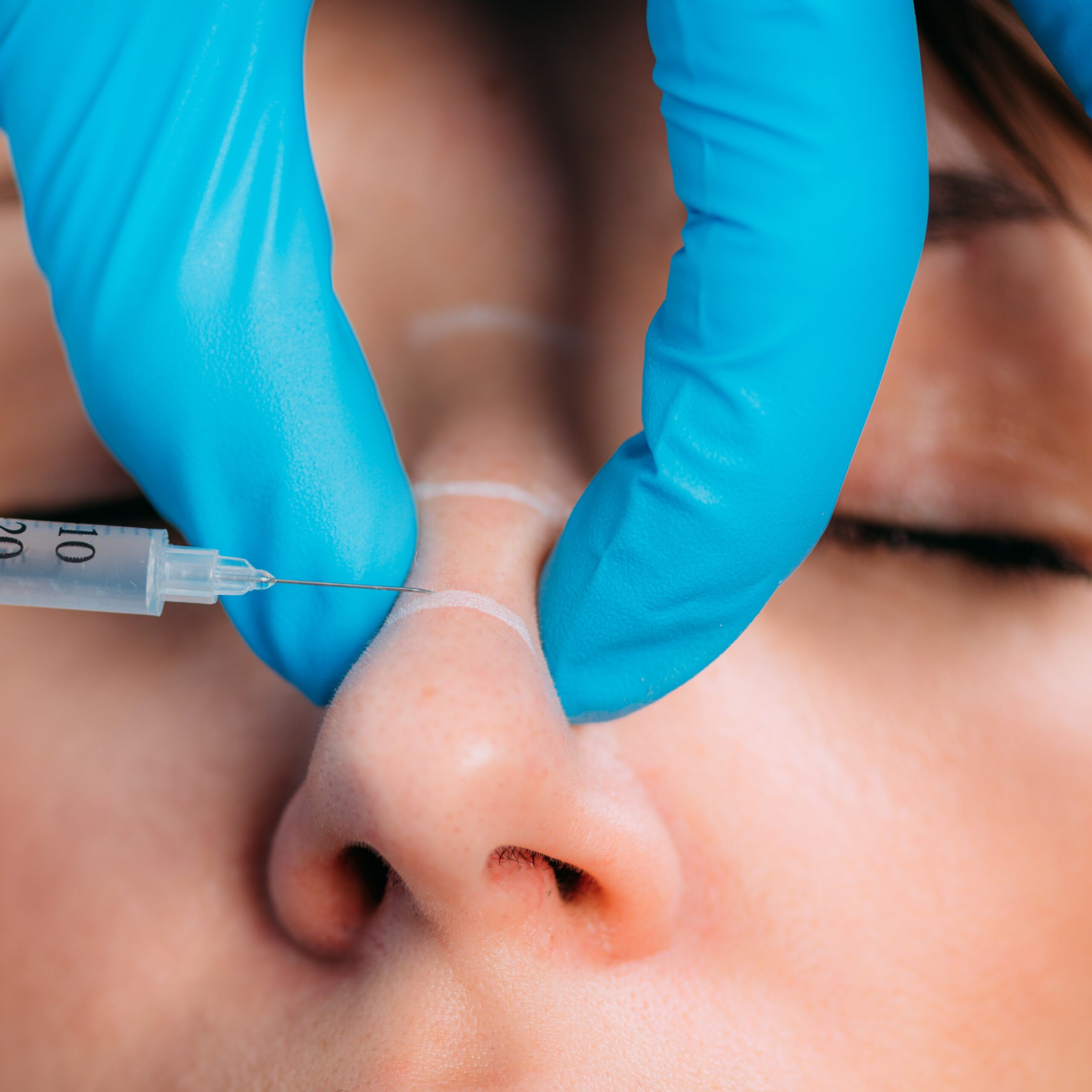 Casos en los que la rinomodelación encaja mejor