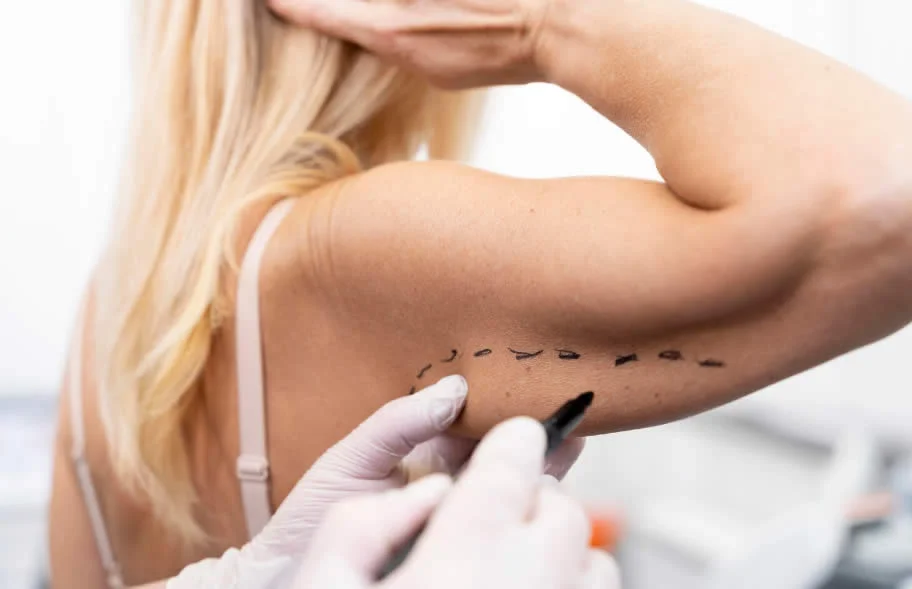 lifting-de-brazos-barcelona