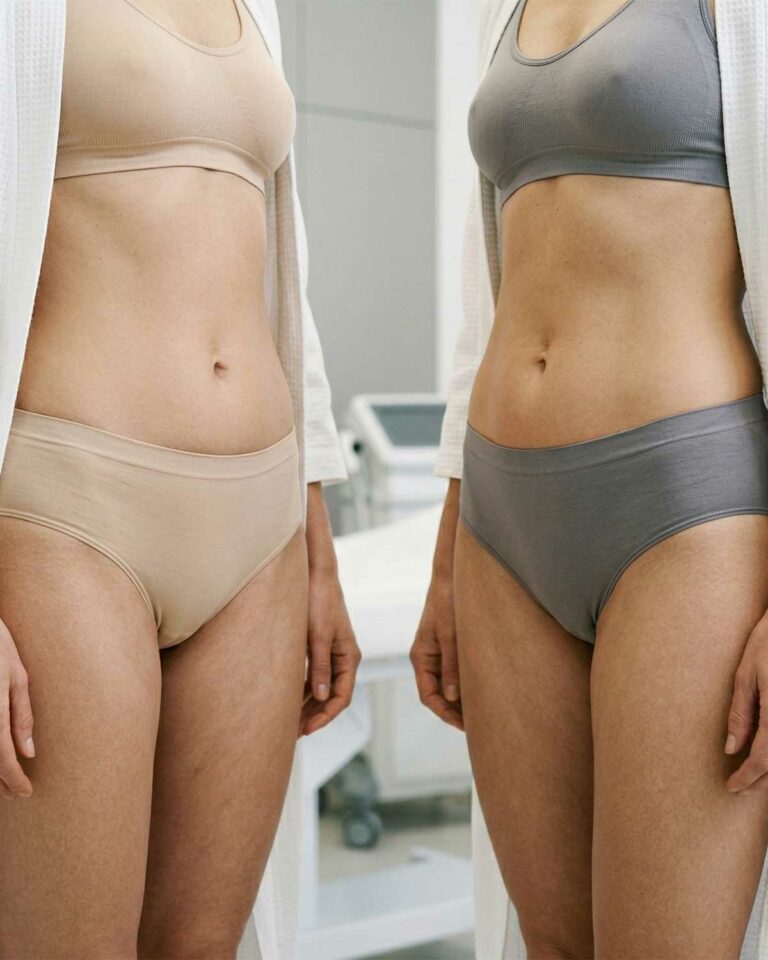 Tipo de liposucción o lipoescultura