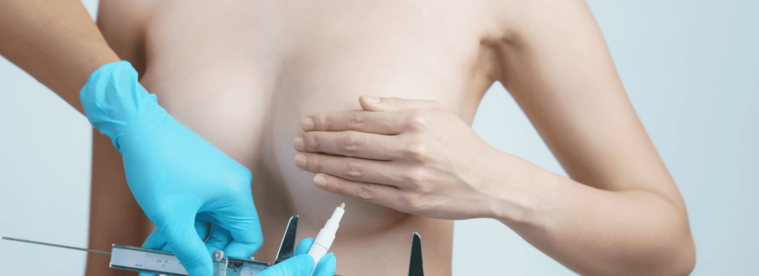 Minimal Scar Barcelone