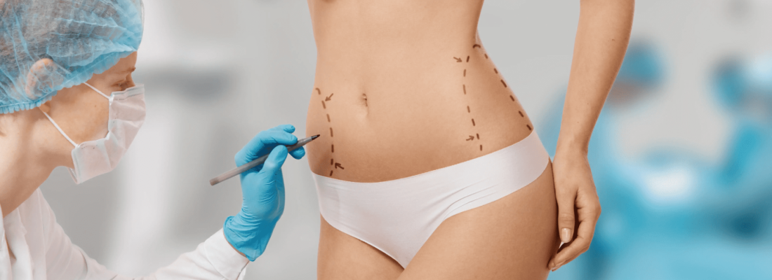 Liposucció barcelona preu